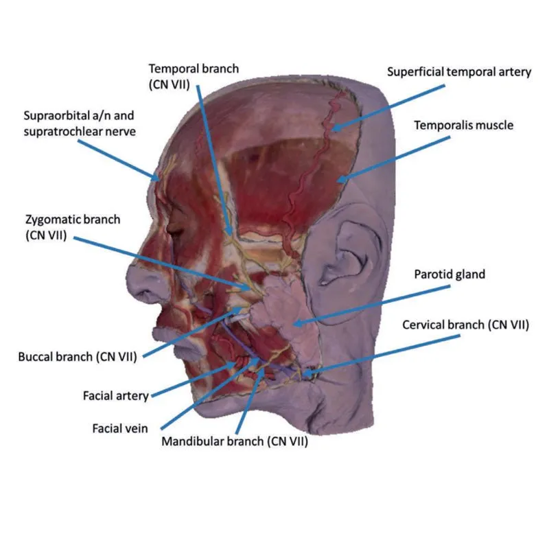 3D Printed Superficial Face